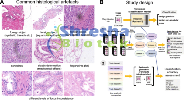 PATHOLOGY CHARTS AND POINEERS