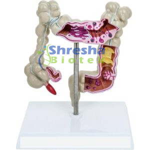 PATHOLOGY MODELS AND SLIDES